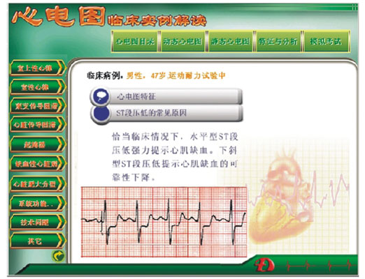 新版心電圖教學(xué)軟件 心電圖臨床實(shí)例解讀